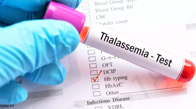 kerana thalassemia